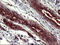 BH3 Interacting Domain Death Agonist antibody, LS-C797742, Lifespan Biosciences, Immunohistochemistry frozen image 