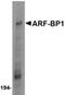 E2F-1 antibody, orb5097, Biorbyt, Western Blot image 