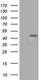 3-Hydroxyisobutyryl-CoA Hydrolase antibody, TA501332, Origene, Western Blot image 