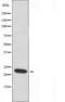NDUFA4 Mitochondrial Complex Associated antibody, orb226573, Biorbyt, Western Blot image 