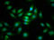 CDC42 Binding Protein Kinase Beta antibody, LS-C672166, Lifespan Biosciences, Immunofluorescence image 