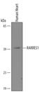 Retinoic Acid Receptor Responder 1 antibody, AF4255, R&D Systems, Western Blot image 