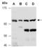 Netrin receptor UNC5B antibody, R2351-1, Abiocode, Western Blot image 