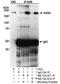 WRN RecQ Like Helicase antibody, NB100-472, Novus Biologicals, Western Blot image 