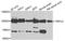 Short transient receptor potential channel 3 antibody, A7742, ABclonal Technology, Western Blot image 