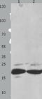 Fas Associated Via Death Domain antibody, TA321602, Origene, Western Blot image 