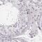 Keratin 82 antibody, NBP2-57921, Novus Biologicals, Immunohistochemistry paraffin image 