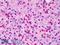 TPIS antibody, LS-B2611, Lifespan Biosciences, Immunohistochemistry paraffin image 