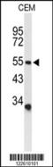 Amiloride-sensitive cation channel 2, neuronal antibody, 63-864, ProSci, Western Blot image 