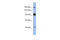 Mediator Complex Subunit 23 antibody, ARP34880_P050, Aviva Systems Biology, Western Blot image 