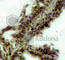 Akt antibody, AP0304, ABclonal Technology, Immunohistochemistry paraffin image 