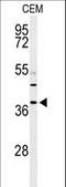 Ribonuclease H2 Subunit B antibody, LS-C162640, Lifespan Biosciences, Western Blot image 