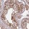 Zinc Finger Protein 624 antibody, HPA023244, Atlas Antibodies, Immunohistochemistry frozen image 