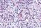 C-C Motif Chemokine Receptor 7 antibody, MBS243910, MyBioSource, Immunohistochemistry frozen image 