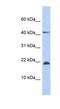 SREK1 Interacting Protein 1 antibody, NBP1-54710, Novus Biologicals, Western Blot image 