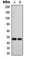 C-Terminal Binding Protein 1 antibody, LS-C355983, Lifespan Biosciences, Western Blot image 