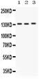Integrin Subunit Alpha 1 antibody, PA1045-1, Boster Biological Technology, Western Blot image 