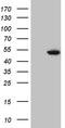 Estrogen Related Receptor Alpha antibody, TA809202S, Origene, Western Blot image 