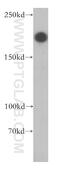 Neuroblastoma-amplified sequence antibody, 14683-1-AP, Proteintech Group, Western Blot image 