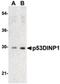 Tumor Protein P53 Inducible Nuclear Protein 1 antibody, PA5-20009, Invitrogen Antibodies, Western Blot image 