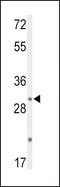 Dual Specificity Phosphatase 2 antibody, 63-775, ProSci, Western Blot image 