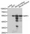Membrane Palmitoylated Protein 1 antibody, STJ28220, St John