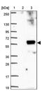 Solute Carrier Family 45 Member 3 antibody, PA5-53915, Invitrogen Antibodies, Western Blot image 