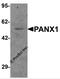 Pannexin 1 antibody, 7097, ProSci Inc, Western Blot image 