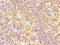 Polypeptide N-Acetylgalactosaminyltransferase 11 antibody, LS-C682188, Lifespan Biosciences, Immunohistochemistry paraffin image 