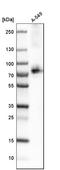 RDR antibody, HPA035239, Atlas Antibodies, Western Blot image 