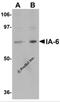 INSM Transcriptional Repressor 2 antibody, 5417, ProSci, Western Blot image 