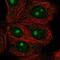 IMP U3 Small Nucleolar Ribonucleoprotein 4 antibody, NBP2-55739, Novus Biologicals, Immunocytochemistry image 