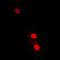 Lymphocyte antigen 6A-2/6E-1 antibody, orb94879, Biorbyt, Immunofluorescence image 