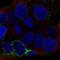 Ceroid-lipofuscinosis neuronal protein 6 antibody, NBP2-56415, Novus Biologicals, Immunocytochemistry image 