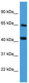Collagen alpha-2(VIII) chain antibody, TA342821, Origene, Western Blot image 