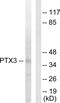 Pentraxin 3 antibody, PA5-38595, Invitrogen Antibodies, Western Blot image 