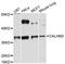 Calcium Homeostasis Modulator Family Member 2 antibody, LS-C748071, Lifespan Biosciences, Western Blot image 