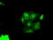Pim-2 Proto-Oncogene, Serine/Threonine Kinase antibody, TA501063, Origene, Immunofluorescence image 