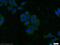 Akt antibody, 60203-2-Ig, Proteintech Group, Immunofluorescence image 