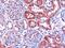 Dicarbonyl And L-Xylulose Reductase antibody, 45-479, ProSci, Immunohistochemistry frozen image 