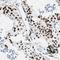 Zinc Finger Protein 131 antibody, HPA007023, Atlas Antibodies, Immunohistochemistry paraffin image 