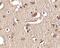 SLIT And NTRK Like Family Member 2 antibody, PA5-20472, Invitrogen Antibodies, Immunohistochemistry paraffin image 