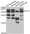 Prostate Stem Cell Antigen antibody, TA332789, Origene, Western Blot image 