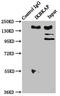 Elongator Complex Protein 1 antibody, LS-C680653, Lifespan Biosciences, Immunoprecipitation image 