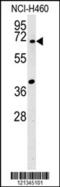 Synapsin III antibody, 62-038, ProSci, Western Blot image 