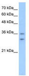 Olfactory Receptor Family 6 Subfamily C Member 70 antibody, TA336170, Origene, Western Blot image 