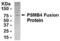 Proteasome Subunit Beta 4 antibody, XW-8085, ProSci, Western Blot image 