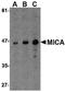 MHC Class I Polypeptide-Related Sequence A antibody, LS-B1377, Lifespan Biosciences, Western Blot image 