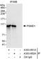 Proteasome 26S Subunit, Non-ATPase 1 antibody, A303-852A, Bethyl Labs, Immunoprecipitation image 