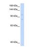DNA replication licensing factor MCM8 antibody, NBP1-58129, Novus Biologicals, Western Blot image 